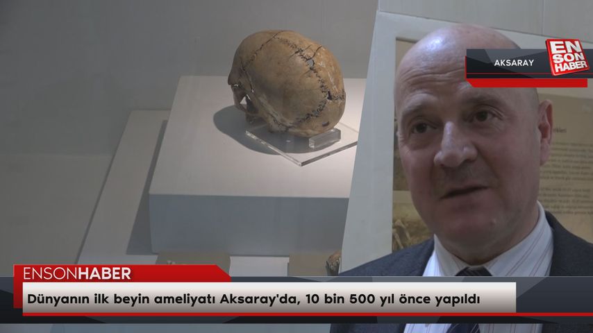 Dünyanın ilk beyin ameliyatı Aksaray'da, 10 bin 500 yıl önce yapıldı