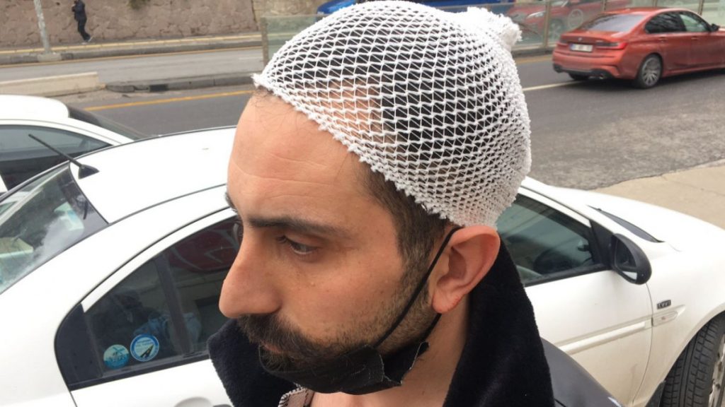 Ankara’daki taksici müşterisini darbetti