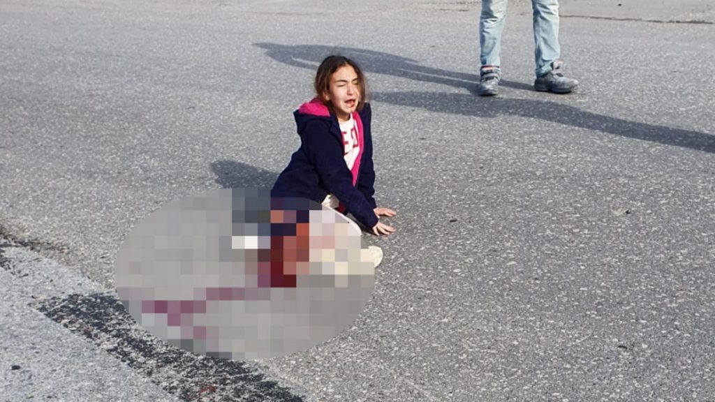 Antalya’da köpekten kaçarken ezilen Mahra, hayata döndürüldü