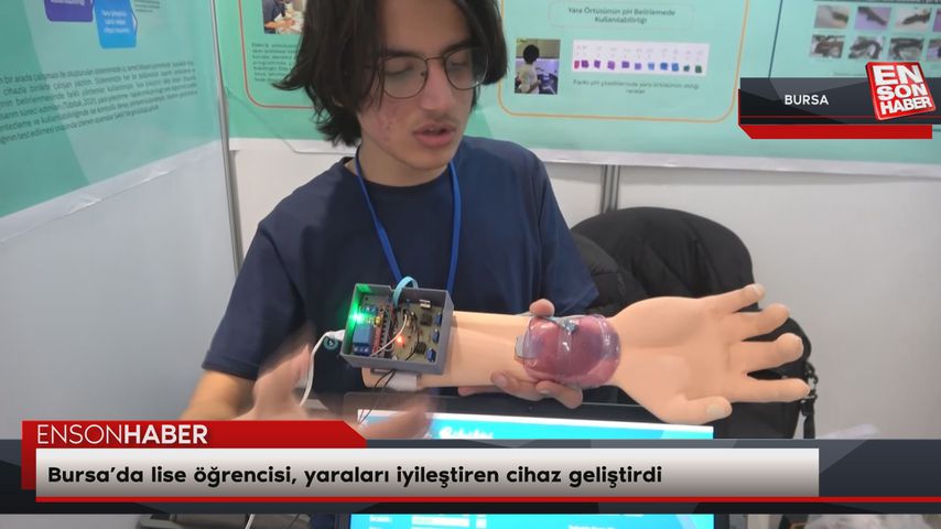 Bursa’da lise öğrencisi, yaraları iyileştiren cihaz geliştirdi