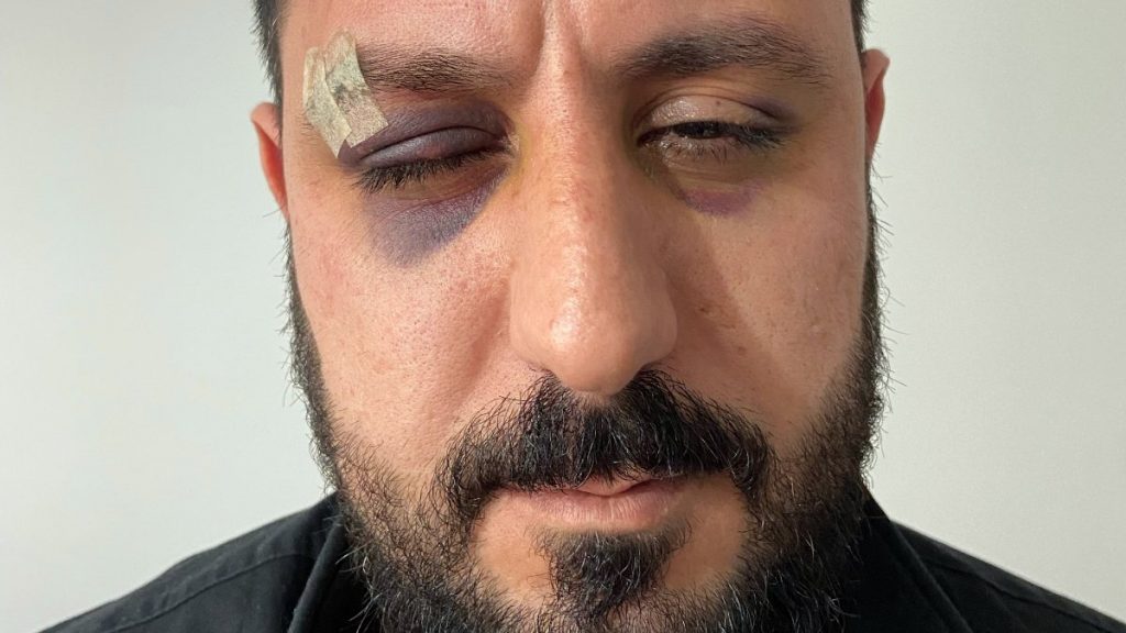 Esenyurt’ta apartmanına giren şahıslardan dayak yedi