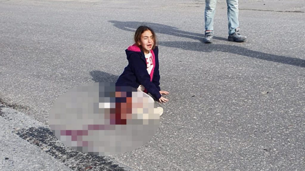 Köpekten kaçarken ayağından olan Mahra’nın beyin ölümü gerçekleşebilir