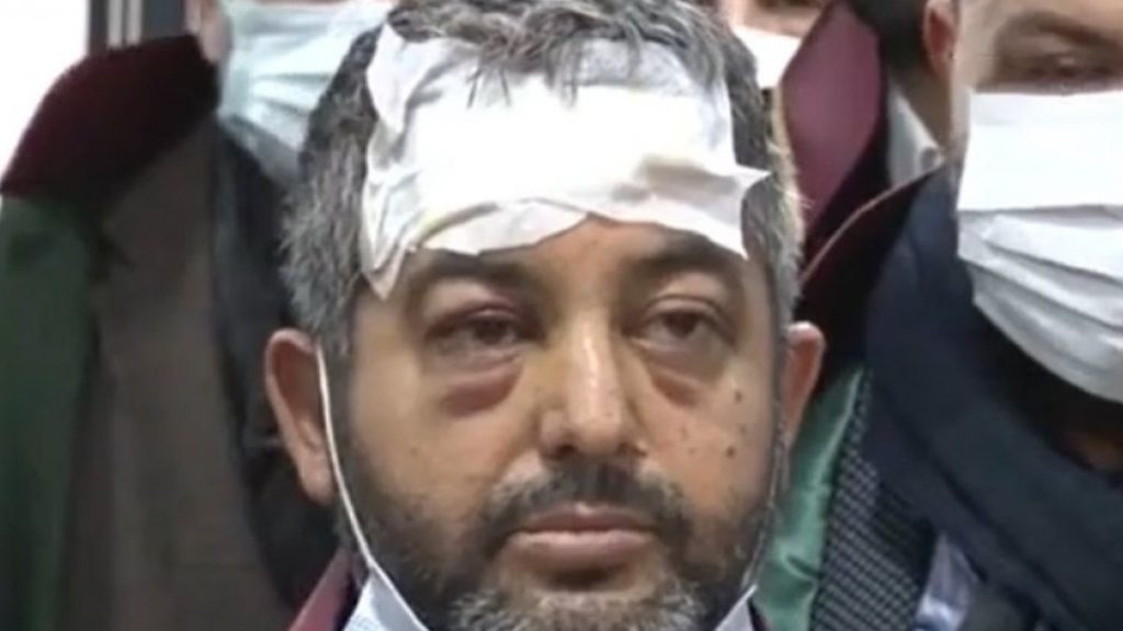 Küçükçekmece’de avukata saldıran sanık tahliye edildi