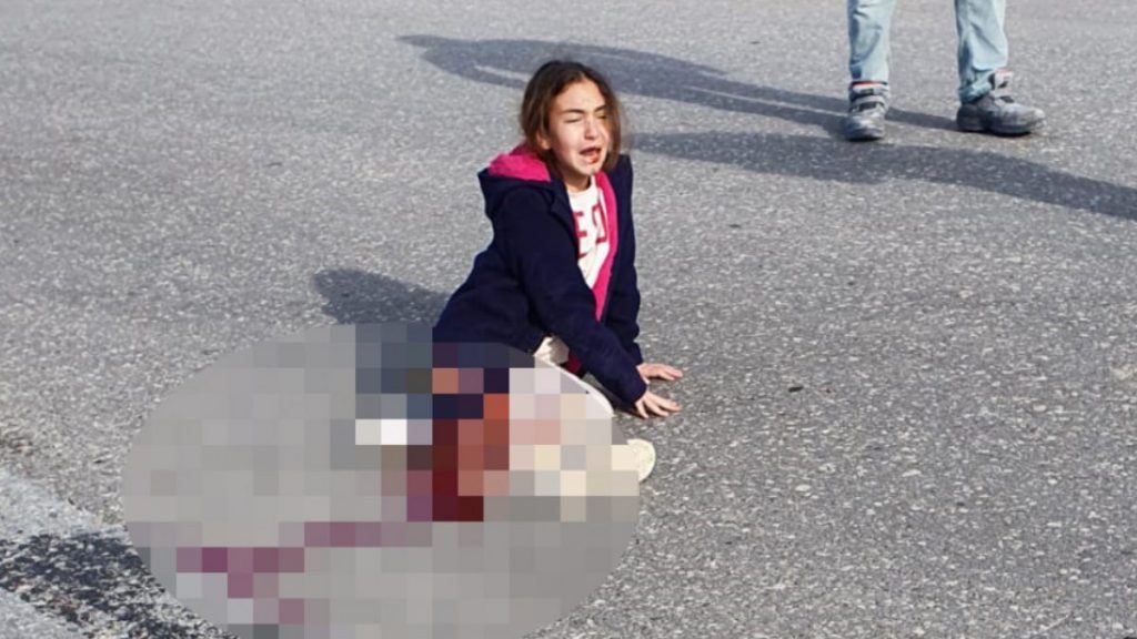 Sağ bacağı kesilen Mahra’nın durumu ağırlaştı