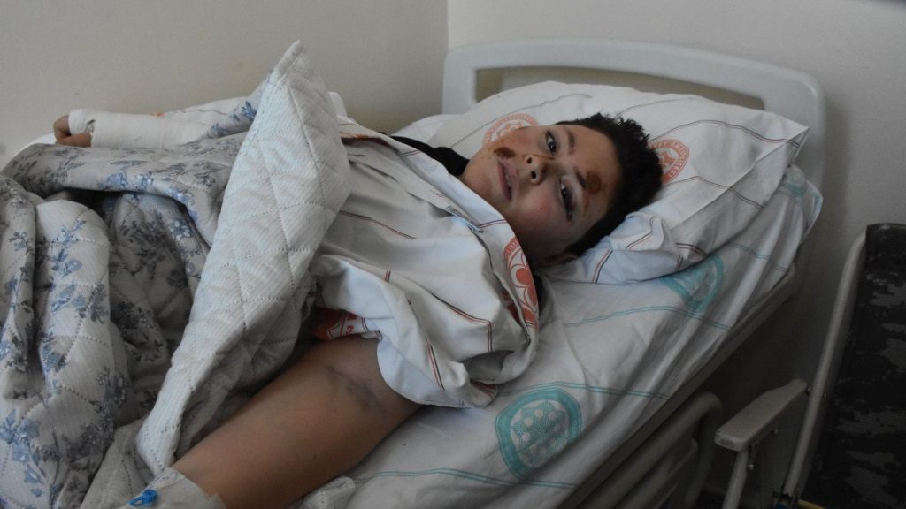 Sivas’ta köpekten kaçarken otomobilin çarptığı çocuk, hayati tehlikeyi atlattı