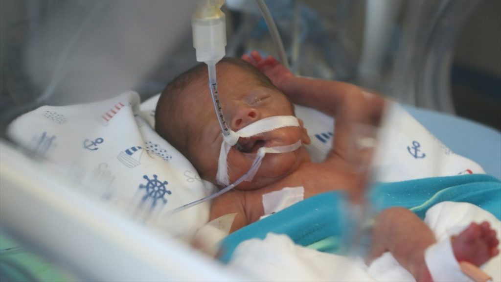 Tekirdağ’da 5,5 aylık doğan bebek kök hücreyle tedavi edildi