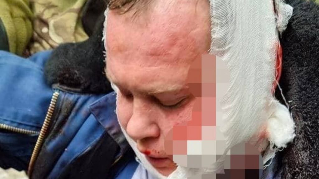 Ukrayna’da düşürülen uçağın pilotu halk yakaladı