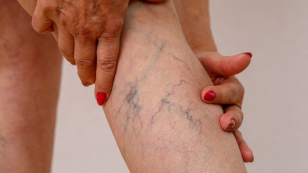 Varis geçiren ‘Aloe Vera ve elma sirkesi’ karışımı