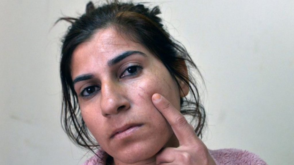 Adana’da Suriyeli Ceylan’ın hayatı kabusa döndü