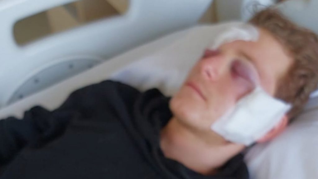 Balıkesir’de arkadaşının oynadığı silahla şakağından vuruldu