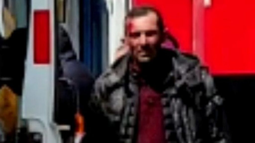 Kars’taki genç kadın 2 gün önce boşandığı eşi tarafından vuruldu